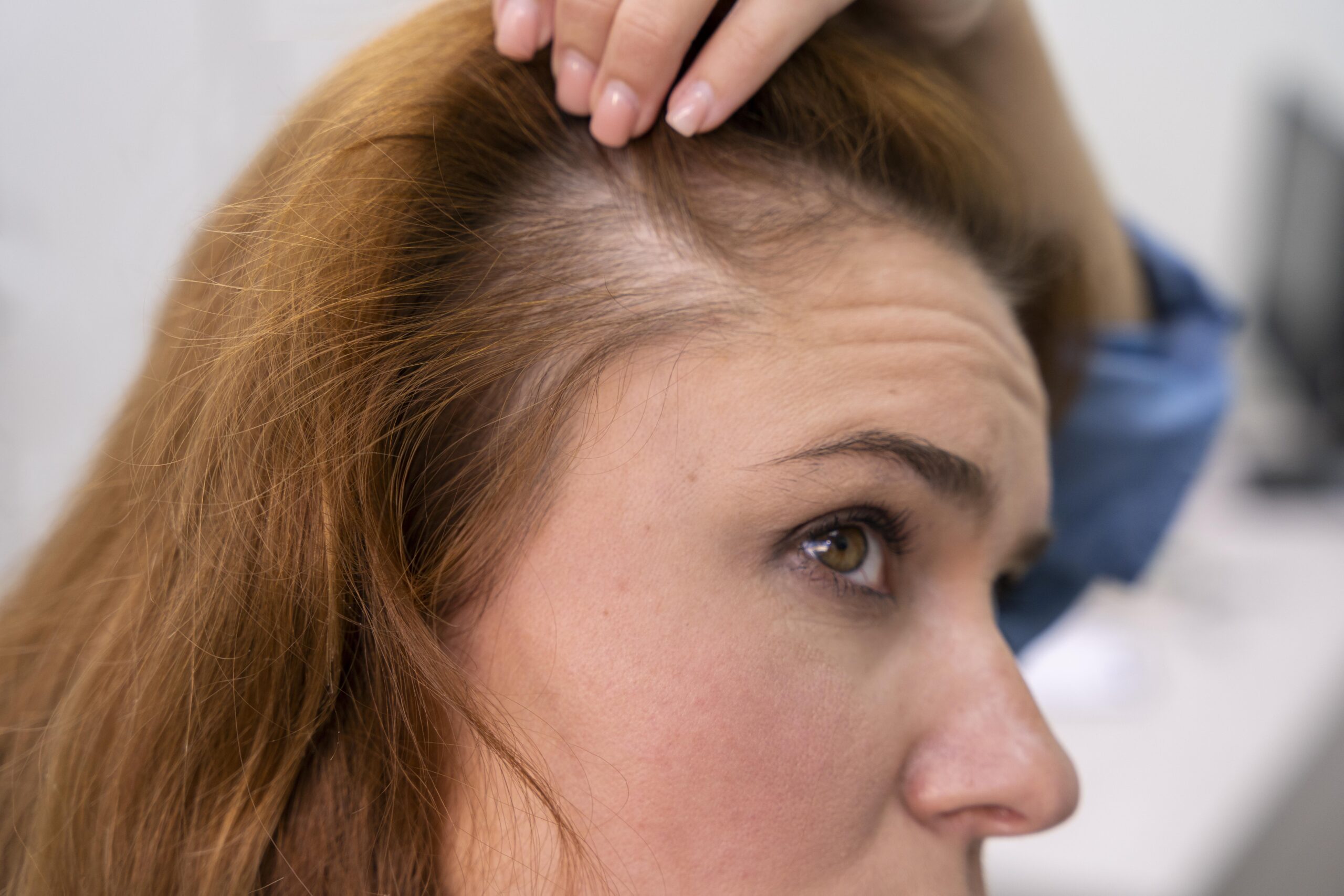 Best Stem Cell Treatment for Hair Loss